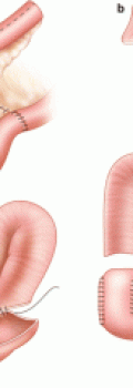 307466_1_En_12_Fig1_HTML-300x240