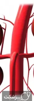 kidney