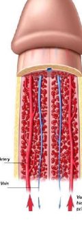 priapism